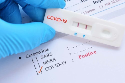 What to know about the new COVID-19 XEC variant