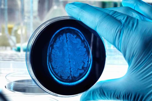 Why growing human brain tissue in a dish is an ethical minefield