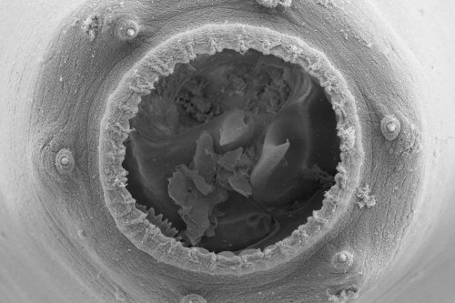 Tiny nematode worms can grow enormous mouths and become cannibals