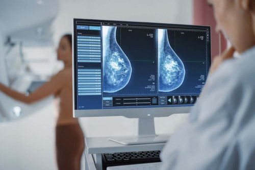 Extra cancer screening could help pick up early cases in dense breasts
