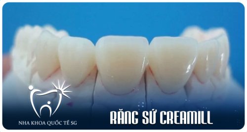 Răng Sứ Ceramill Là Gì? Những Điều Bạn Cần Biết Về Loại Răng Sứ Này