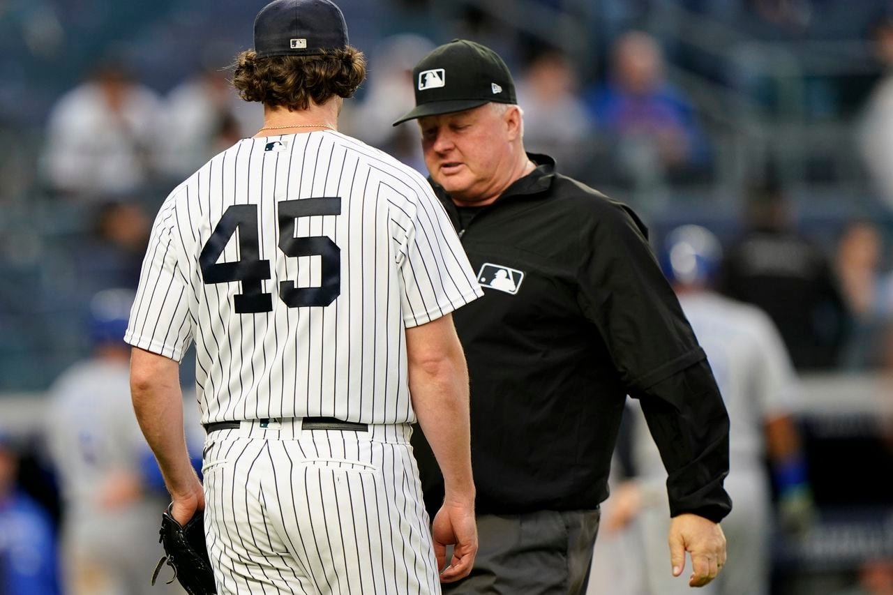 Yankees’ Gerrit Cole reacts to uncomfortable sticky substance checks
