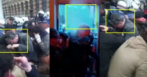 « Des croûtes partout au visage » : l’élu écolo aspergé de gaz lacrymogène « à bout portant » devant un bar à Lille témoigne