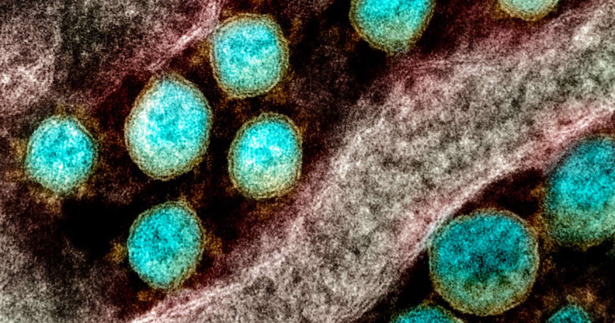 Coronavirus : le virus aurait muté une première fois en une version plus dangereuse