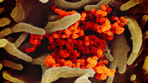 IMAGES: What New Coronavirus Looks Like Under The Microscope