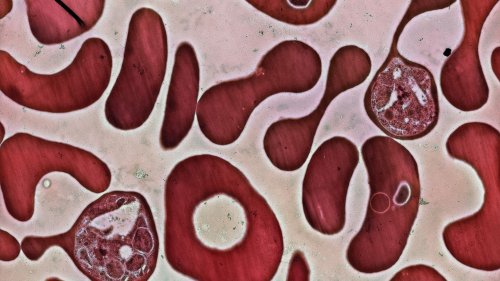 Experimental Malaria Vaccine Blocks The Bad Guy's Exit