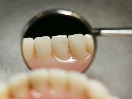 The value of good teeth