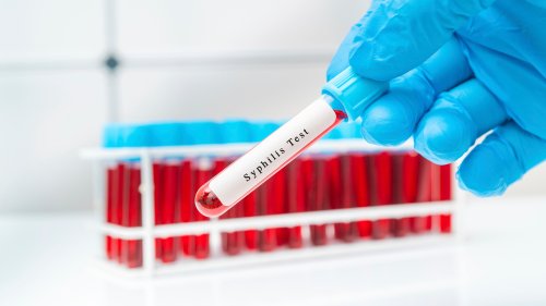 Once On The Brink Of Eradication, Syphilis Is Raging Again