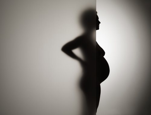 Losing a pregnancy could land you in jail in post-Roe America