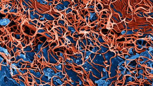 Johnson & Johnson Pushes Ahead With Ebola Vaccine