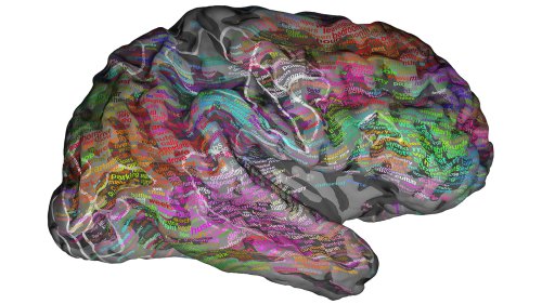 Scans Show 'Brain Dictionary' Groups Words By Meaning