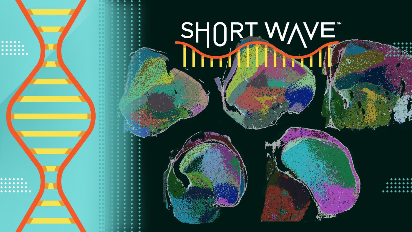 How nature makes a complex brain — and why humans may not be so special after all : Short Wave
