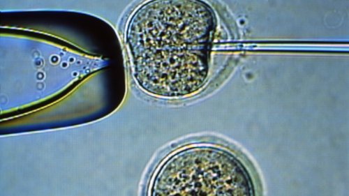First Embryonic Stem Cells Cloned From A Man's Skin