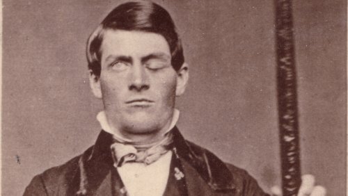 Why Brain Scientists Are Still Obsessed With The Curious Case Of Phineas Gage