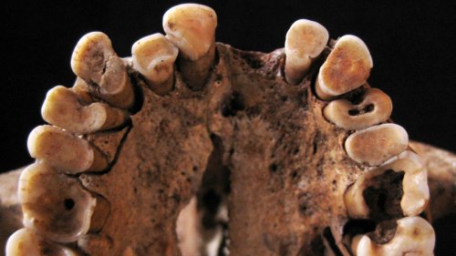Looks Like The Paleo Diet Wasn't Always So Hot For Ancient Teeth