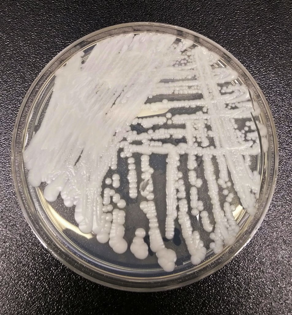 COVID-19 🦠 GLOBAL PANDEMIC