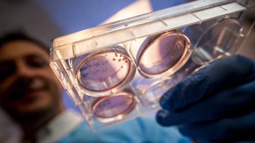 'Minibrains' With A Neanderthal Gene Offer Hints About Human Evolution