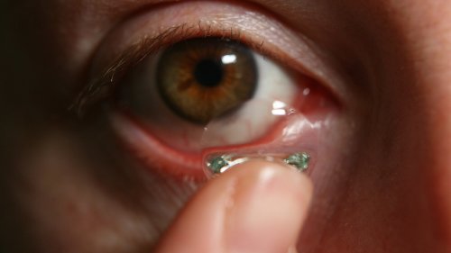 Doctors Report Removing 27 Contact Lenses From A Woman's Eye