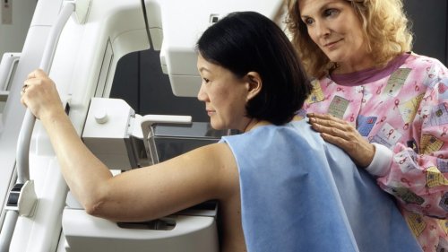 90% of Women Appear Misinformed About Mammograms