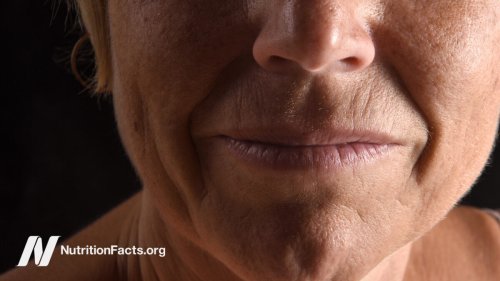 What Causes Wrinkles? | NutritionFacts.org