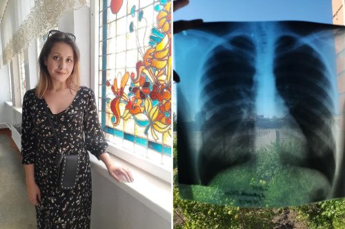 i-went-into-the-hospital-with-pneumonia-and-discovered-all-my-organs