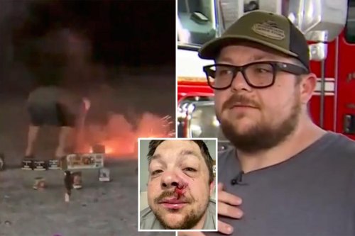 Firefighter father struck by lightning in Alabama exactly one year after firework exploded in his face: ‘Lucky to be here’