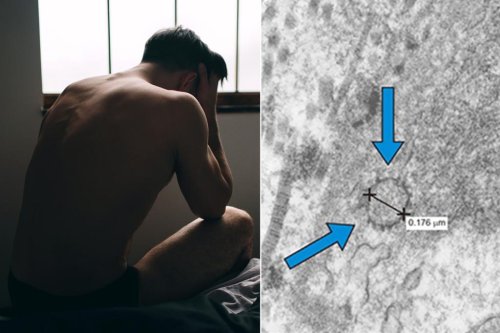 Man claims his penis shrank 1.5 inches, ‘COVID d – – k is real’ say docs