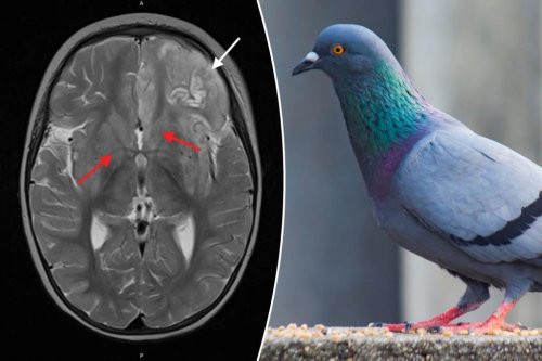 Toddler, 2, dies from rare pigeon virus — only the 5th person to do so