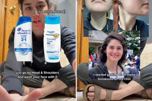 Viral TikTok trend has people washing their faces with Head & Shoulders shampoo
