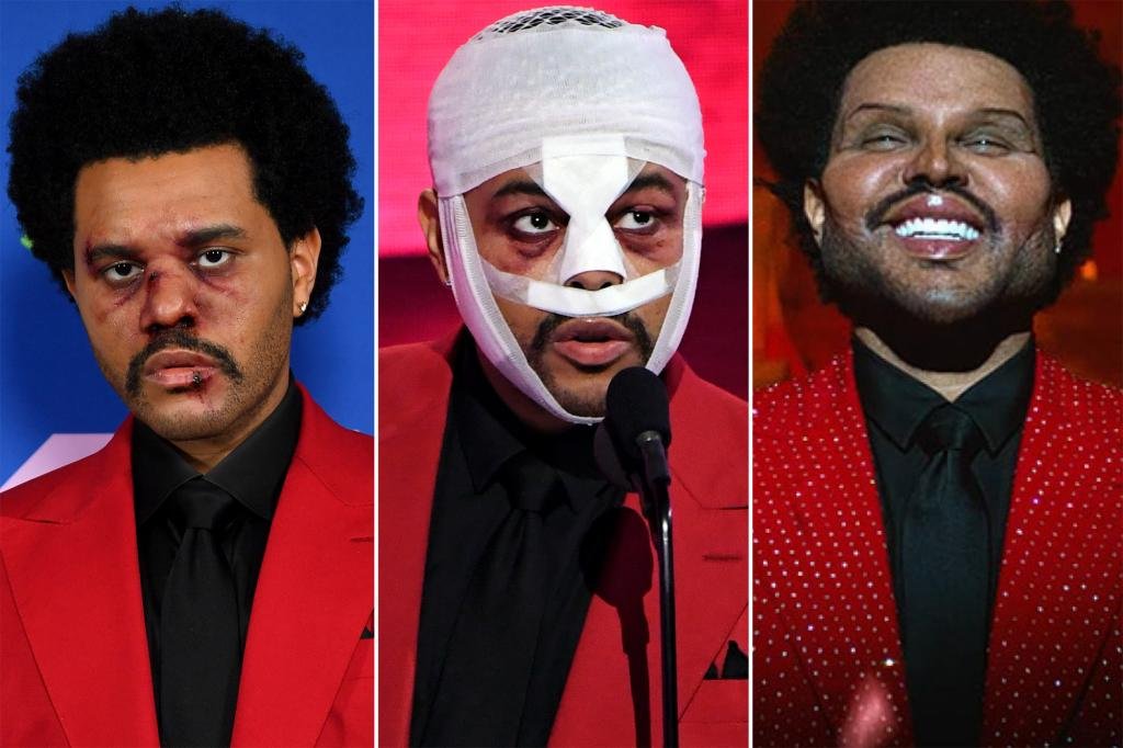 Secrets of The Weeknd’s face: From bloody horror to ‘surgery’ shocker