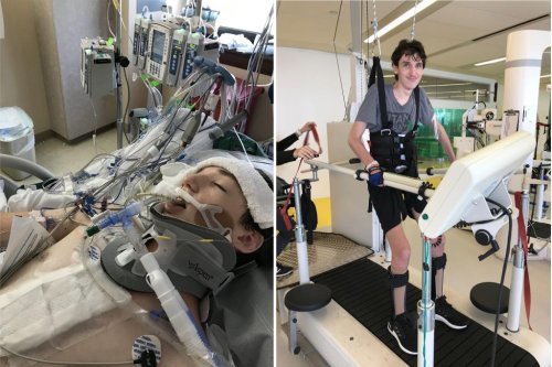 ‘miracle Teen Who ‘died For An Hour After Being Struck By Lightning Learns To Walk Again 