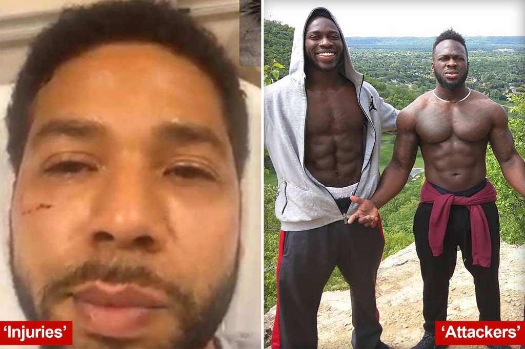 OPINION | Jussie Smollett should face justice for hurting race relations in America — and undercutting the real victims