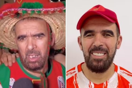World Cup fan bullied over bad teeth gets stunning free makeover from celebrity dentist