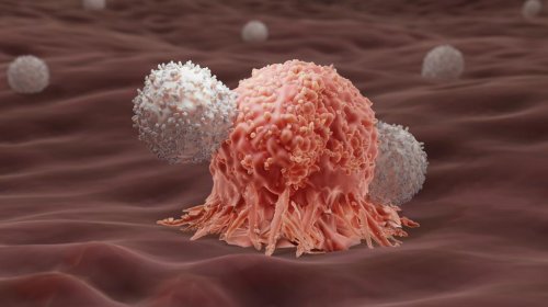 Why CAR-T cell therapy is the cancer killer the world needs now