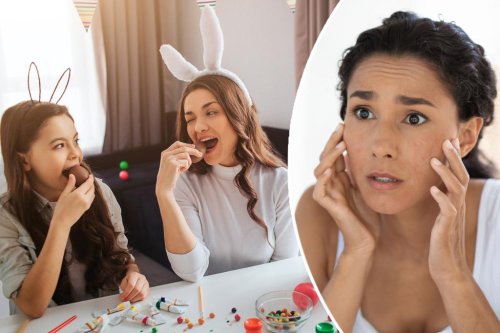 7 hacks to save your skin after an Easter candy binge without giving up chocolate — including a 2-ingredient acne fix
