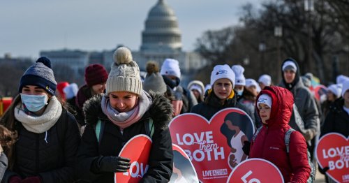 How U.S. Abortion Law Compares With Other Nations