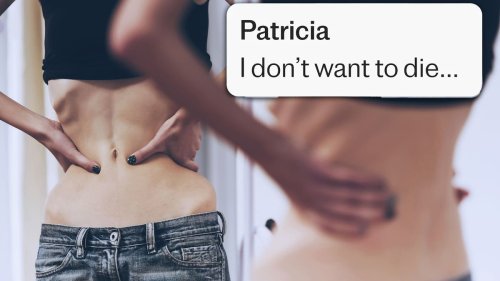 British NHS refuses to force-feed anorexic woman at ‘imminent’ risk of death