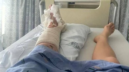 Woman with fractures waits 11 days for surgery in Waikato Hospital