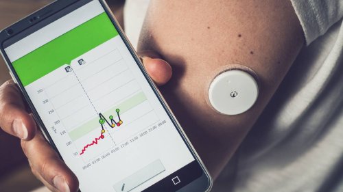 Diabetes NZ Wants Pharmac To Fund life changing Monitors For 