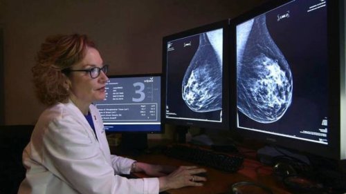 Kiwi med-tech Volpara buying US rival for $22m