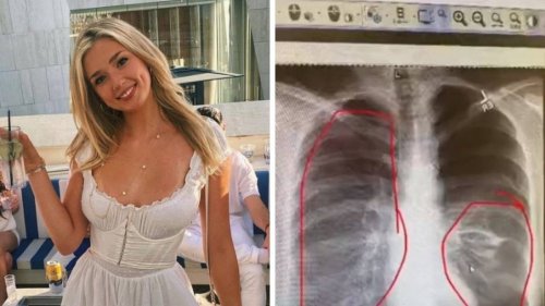 Woman's vaping warning after terrifying health scare that left doctors 'freaked out'