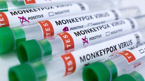 Affenpocken: Deutschland hat erste Impfdosen erhalten +++ Symptome unterscheiden sich laut britischer Studie von früheren Ausbrüchen