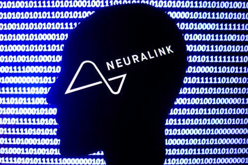 Elon Musk’s Neuralink Is Preparing for Human Brain Chip Trial With Key Hires