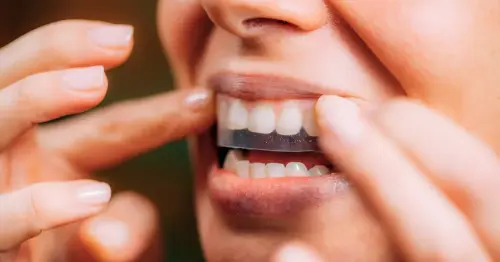 Amazon shoppers rave over £20 dentist-approved teeth whitening strips that boost confidence