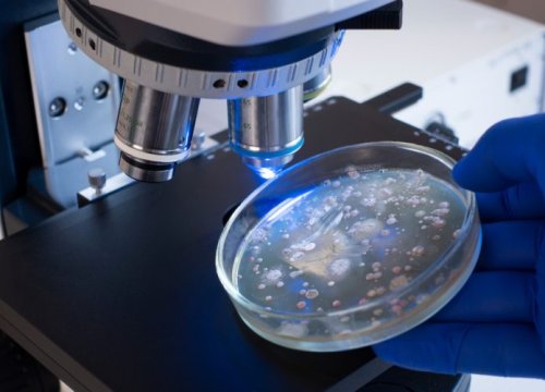 Harvard: novo antibiótico pode vencer as superbactérias