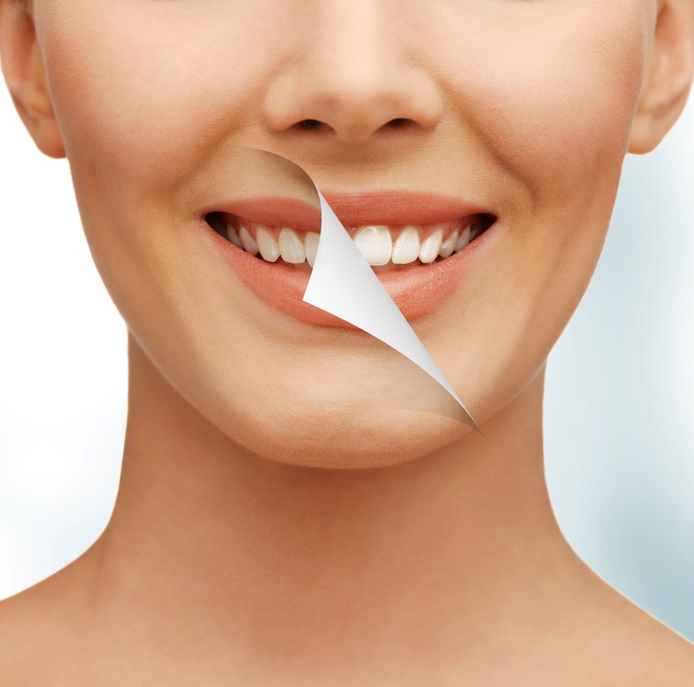 The Best Whitening Solution for Sensitive Teeth