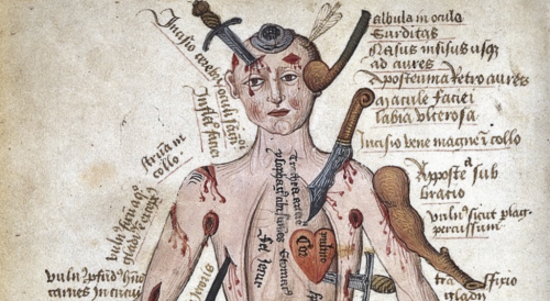 Behold the Medieval Wound Man: The Poor Soul Who Illustrated the Injuries a Person Might Receive Through War, Accident or Disease