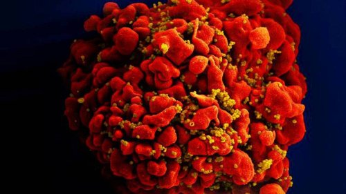 États-Unis : un homme guérit du VIH et d’une leucémie après une greffe de cellules souches
