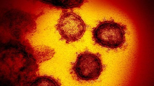 Pourquoi le nouveau virus « Langya » découvert en Chine n’est pas du tout comparable au Covid-19