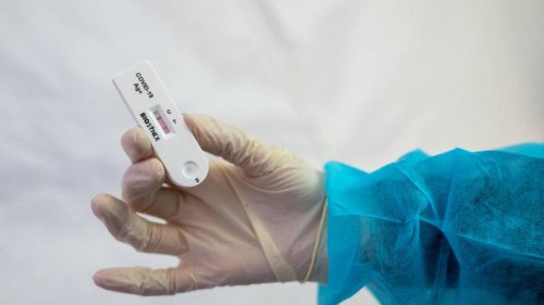Covid-19. En Bretagne, 36,4 % des tests PCR ou antigéniques réalisés sont positifs